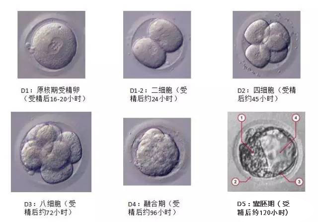 安徽赠卵试管婴儿取卵后会发生卵巢过度刺激吗？