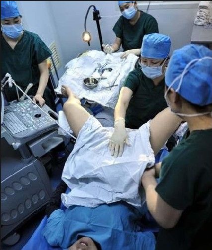 安徽市妇幼保健院供卵试管婴儿费用