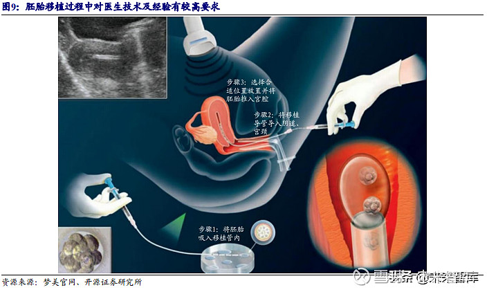 破卵针在做借卵供卵三代试管生育过程中的作用是什么？