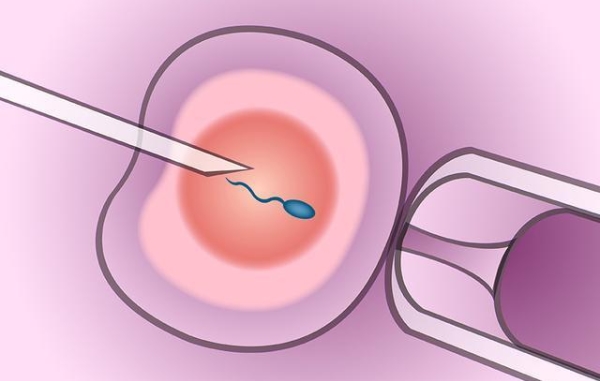 做供卵试管宫外孕的几率高吗