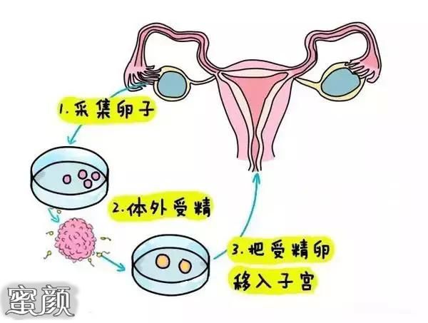 为了防止孕酮高,国内代怀生子机构移植前要注意什么